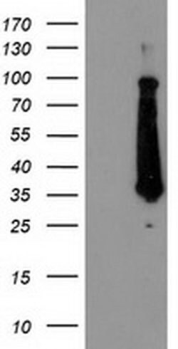 FAM119A Monoclonal Antibody (OTI2G7), TrueMAB , OriGene 100 &mu;L | Buy Online | OriGene | Fisher Scientific