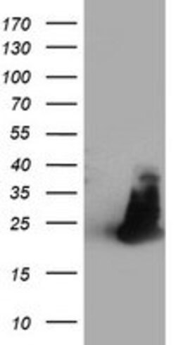 FAM119A Mouse anti-Human, Clone: OTI2D3, lyophilized, TrueMAB 100 &mu;g;