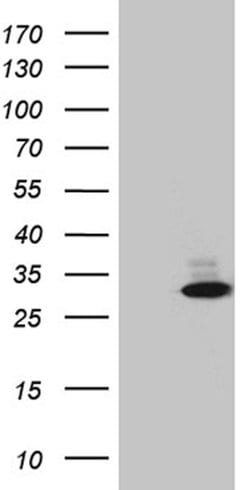 FAM119A Mouse anti-Human, Clone: OTI2A8, lyophilized, TrueMAB 100 &mu;g;