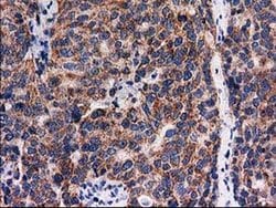 FAM127C Monoclonal Antibody (OTI1A6), TrueMAB , OriGene 100 &mu;L; Unconjugated:Antibodies,