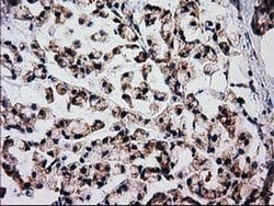 FAM127C Monoclonal Antibody (OTI1A6), TrueMAB , OriGene 100 &mu;L; Unconjugated:Antibodies,