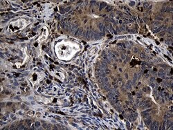 FAM131C Monoclonal Antibody (OTI1C2), TrueMAB , OriGene:Antibodies:Primary