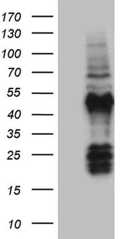 FAM131C Monoclonal Antibody (OTI1C2), TrueMAB , OriGene 100 &mu;L; Unconjugated:Antibodies,
