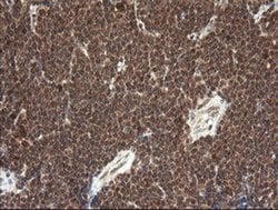 FAM164A Monoclonal Antibody (OTI4B5), TrueMAB , OriGene 100 &mu;L; Unconjugated:Antibodies,