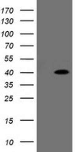 FAM164A Mouse anti-Human, Clone: OTI2D1, lyophilized, TrueMAB 100 &mu;g;