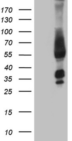 FAM170A Monoclonal Antibody (OTI4C6), TrueMAB , OriGene 100 &mu;L | Buy Online | OriGene | Fisher Scientific