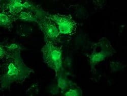 FAM40A Monoclonal Antibody (OTI7B8), TrueMAB , OriGene 100 &mu;L; Unconjugated:Antibodies,