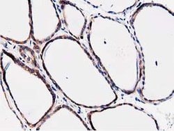 FAM40A Monoclonal Antibody (OTI7B8), TrueMAB , OriGene 100 &mu;L; Unconjugated:Antibodies,