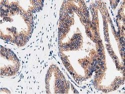 FAM40A Monoclonal Antibody (OTI7B8), TrueMAB , OriGene 100 &mu;L; Unconjugated:Antibodies,