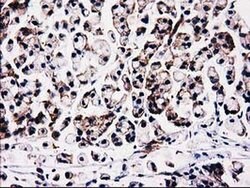 FAM40A Monoclonal Antibody (OTI7B8), TrueMAB , OriGene 100 &mu;L; Unconjugated:Antibodies,