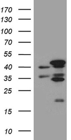 FAM54A Mouse anti-Human, Clone: OTI6C8, lyophilized, TrueMAB 100 &mu;g;