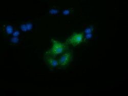 FAM84B Mouse anti-Human, Clone: OTI5G1, lyophilized, TrueMAB 100 &mu;g;