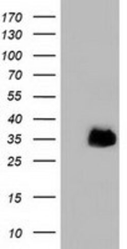 FAM84B Mouse anti-Human, Clone: OTI5A9, lyophilized, TrueMAB 100 &mu;g;