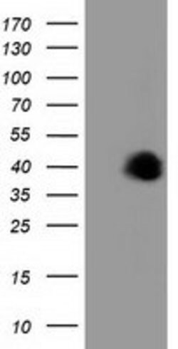 FAM84B Mouse anti-Human, Clone: OTI5B5, lyophilized, TrueMAB 100 &mu;g;