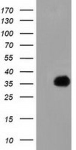 FAM84B Mouse anti-Human, Clone: OTI5G1, lyophilized, TrueMAB 100 &mu;g;
