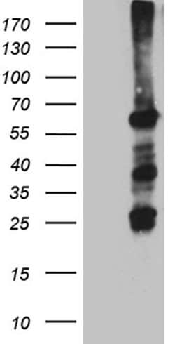 FANCC Monoclonal Antibody (OTI8A7), TrueMAB , OriGene:Antibodies:Primary