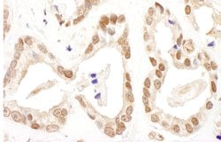 FANCD2 Rabbit anti-Human, Polyclonal, Bethyl Laboratories 100 &mu;L; Unconjugated:Antibodies,