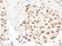 FANCD2 Polyclonal Antibody, Bethyl Laboratories 10 &mu;L; Unconjugated:Antibodies,