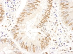 FANCD2 Polyclonal Antibody, Bethyl Laboratories 10 &mu;L; Unconjugated:Antibodies,