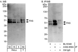 FAS Rabbit anti-Human, Polyclonal, Bethyl Laboratories 100 &mu;L; Unconjugated:Antibodies,