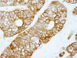 FASN Polyclonal Antibody, Bethyl Laboratories:Antibodies:Primary Antibodies