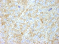 FASN Polyclonal Antibody, Bethyl Laboratories 100 &mu;l; Unlabeled:Antibodies,