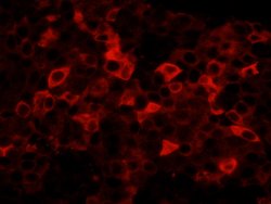 FASN Polyclonal Antibody, Bethyl Laboratories 100 &mu;l; Unlabeled:Antibodies,