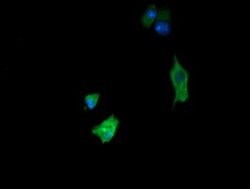 FATE1 Mouse anti-Human, Clone: OTI7B5, lyophilized, TrueMAB 100 &mu;g;