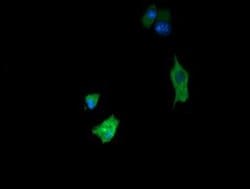FATE1 Monoclonal Antibody (OTI7B5), TrueMAB , OriGene 30 &mu;L; Unconjugated:Antibodies,