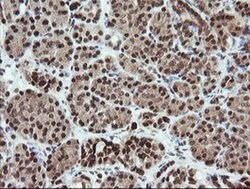FATE1 Monoclonal Antibody (OTI1A1), TrueMAB , OriGene 100 &mu;L; Unconjugated:Antibodies,