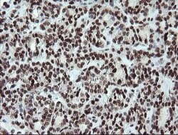 FATE1 Monoclonal Antibody (OTI1A1), TrueMAB , OriGene 100 &mu;L; Unconjugated:Antibodies,