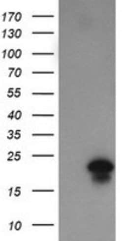 FATE1 Mouse anti-Human, Clone: OTI1A1, lyophilized, TrueMAB 100 &mu;g;