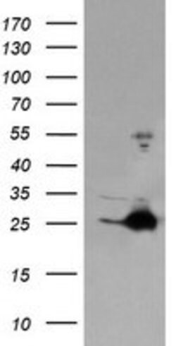 FATE1 Mouse anti-Human, Clone: OTI5E2, lyophilized, TrueMAB 100 &mu;g;