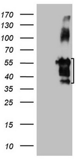 FBLIM1 Monoclonal Antibody (OTI3G1), TrueMAB , OriGene 100 &mu;L; Unconjugated:Antibodies,