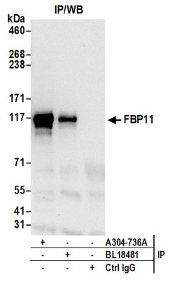 FBP11 Rabbit anti-Human, Polyclonal, Bethyl Laboratories 100 μL; Unconjugated:Antibodies,