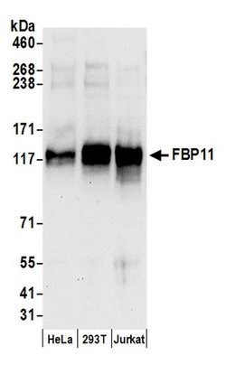 FBP11 Rabbit anti-Human, Polyclonal, Bethyl Laboratories 100 μL; Unconjugated:Antibodies,