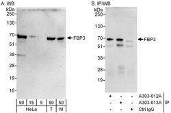 FBP3 Rabbit anti-Human, Mouse, Polyclonal, Bethyl Laboratories 100 &mu;L;