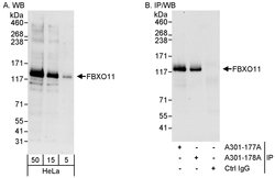 FBXO11 Rabbit anti-Human, Polyclonal, Bethyl Laboratories 100 &mu;L; Unconjugated:Antibodies,
