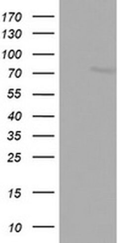 FBXO11 Monoclonal Antibody (OTI1F6), TrueMAB , OriGene 100 &mu;L; Unconjugated:Antibodies,