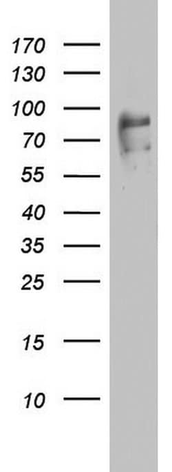 FBXO11 Monoclonal Antibody (OTI1F6), TrueMAB , OriGene:Antibodies:Primary