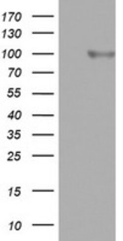 FBXO11 Mouse anti-Human, Clone: OTI1E3, lyophilized, TrueMAB 100 &mu;g;