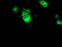 FBXO21 Mouse anti-Human, Clone: OTI1E1, lyophilized, TrueMAB 100 &mu;g;