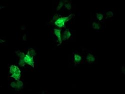 FBXO21 Monoclonal Antibody (OTI2B8), TrueMAB , OriGene 100 &mu;L; Unconjugated:Antibodies,