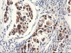 FBXO21 Mouse anti-Human, Clone: OTI1E1, lyophilized, TrueMAB 100 &mu;g;