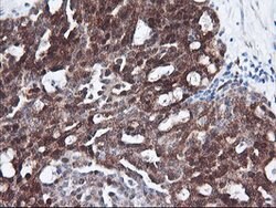 FBXO21 Mouse anti-Human, Clone: OTI1E1, lyophilized, TrueMAB 100 &mu;g;