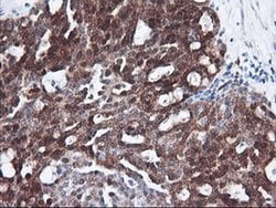 FBXO21 Monoclonal Antibody (OTI1E1), TrueMAB , OriGene 100 &mu;L; Unconjugated:Antibodies,