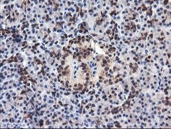FBXO21 Mouse anti-Human, Clone: OTI1E1, lyophilized, TrueMAB 100 &mu;g;