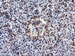 FBXO21 Monoclonal Antibody (OTI1E1), TrueMAB , OriGene:Antibodies:Primary