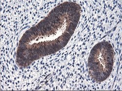 FBXO21 Mouse anti-Human, Clone: OTI1E1, lyophilized, TrueMAB 100 &mu;g;