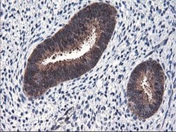 FBXO21 Monoclonal Antibody (OTI1E1), TrueMAB , OriGene 100 &mu;L; Unconjugated:Antibodies,